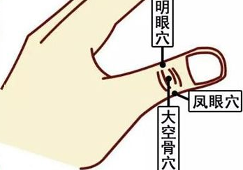 長時間看手機眼花怎么辦，不急，自己按摩三步就可以解決！