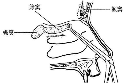 鼻癤的發病病因