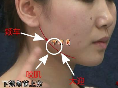 大迎穴針灸