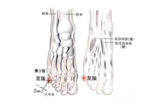 艾灸至陰穴的功效