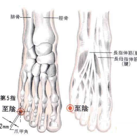 胎兒胎位不正怎么辦？艾灸至陰穴可矯正胎位