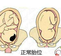 中醫教你如何按摩至陰穴矯正胎位？