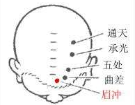 眉沖穴的功效
