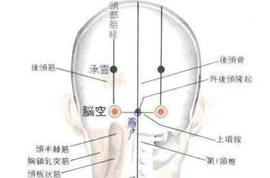 腦空穴的示意圖