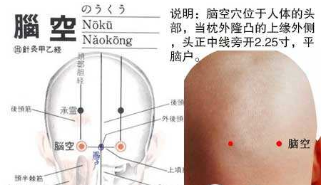 腦空穴