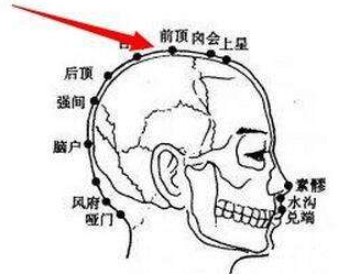 前頂穴示意圖