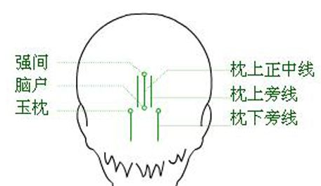強(qiáng)間穴示意圖