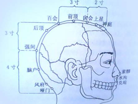 強(qiáng)間穴的刺灸法
