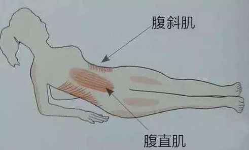 腹直肌鞘內血腫的診斷