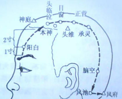 頭竅陰穴的示意圖