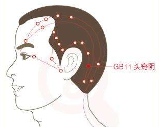 頭竅陰穴的配伍