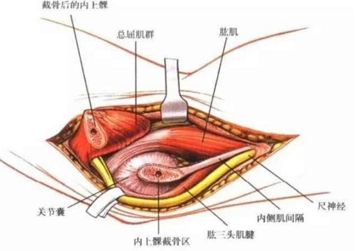 副神經(jīng)損傷原因