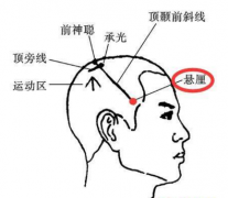 懸厘穴的準(zhǔn)確位置及其懸厘穴治療頭痛的按摩方法介紹！