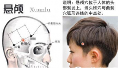 懸顱穴治療偏頭痛的方法有哪些？懸顱穴的功效與作用
