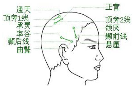 正營穴位位置