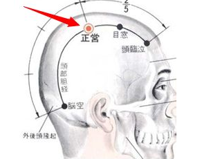 正營穴刺灸法