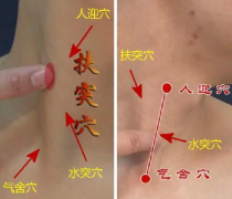 水突穴的位置及其水突穴針刺治療偏頭痛的方法詳解！