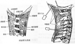 頸部開放性損傷的治療方法及其并發癥有哪些？