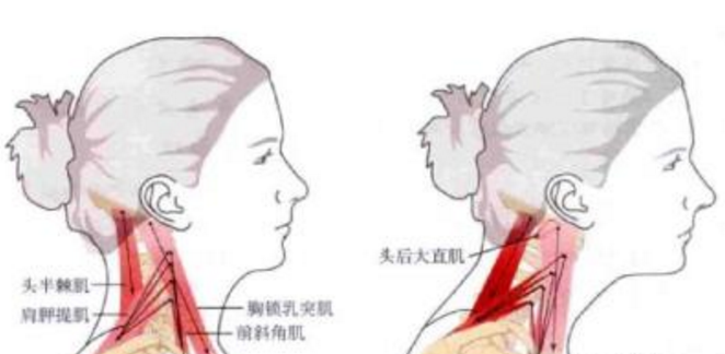 頸部開放性損傷