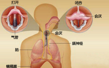 打嗝的原因