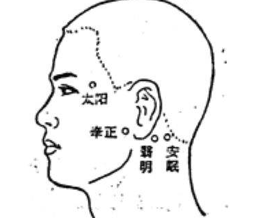 按摩牽正穴