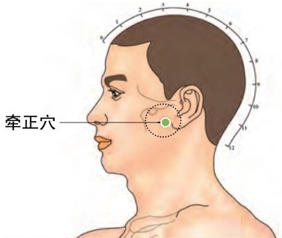 按摩牽正穴治療面癱的方法