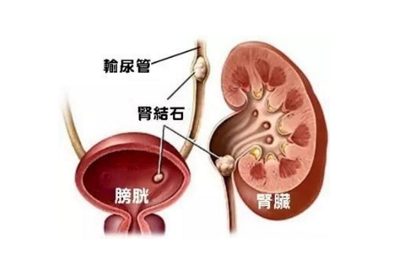 腎病患者的飲食調(diào)養(yǎng)
