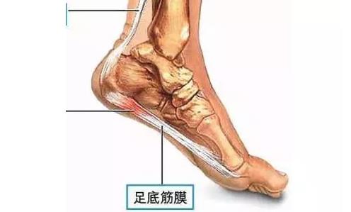 足底三角，不能穿高跟鞋最好別穿！