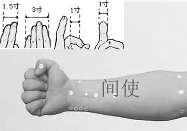 間使穴圖片