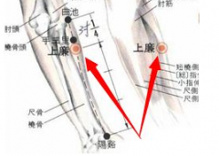 中醫針刺上廉穴治療踝關扭傷的方法及其上廉穴的準確位置！