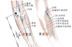 按摩支正穴能治療尖銳濕