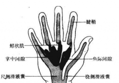 手掌深部間隙感染的預防措施有哪些？手掌深部間隙感染的治療