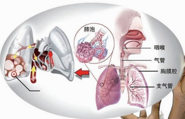 肺大皰的預防