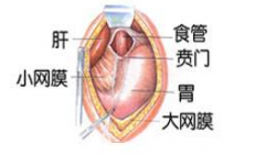 吃不下飯很可能是患上了賁門失弛緩癥！賁門失弛緩癥的鑒別