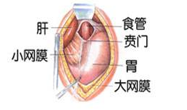 賁門失弛緩癥