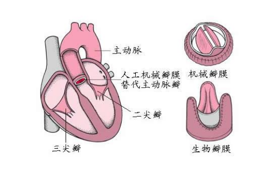 肺動脈發育不全的預防