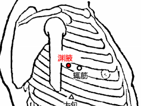 淵腋穴的配伍