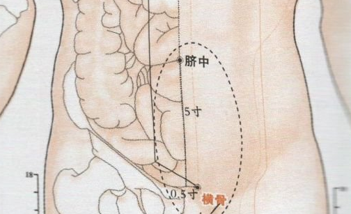 橫骨穴刺灸法