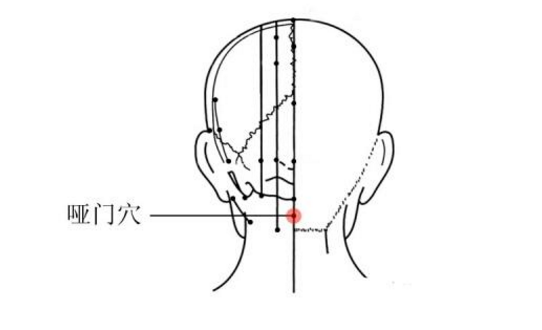 啞門穴主治疾病
