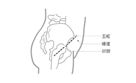 五樞穴穴位配伍